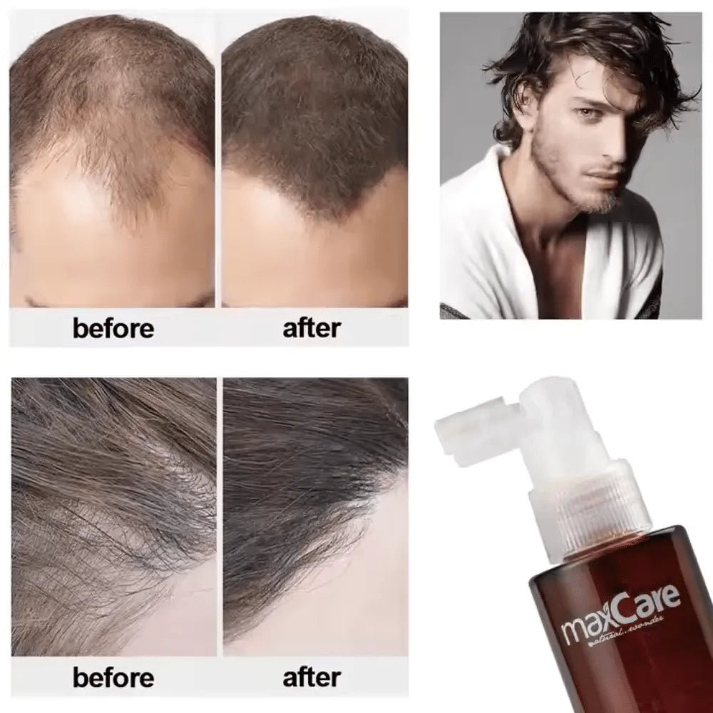 MaxCare Revitalizing Hair Tonic Hair Treatment 120ml 8051414581540
