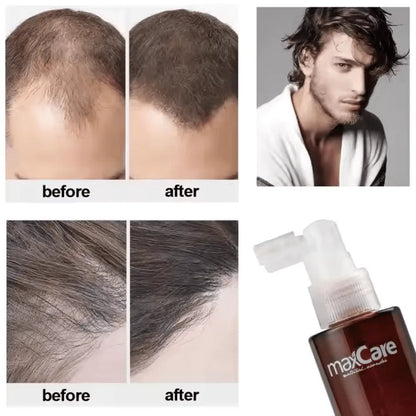MaxCare Revitalizing Hair Tonic Hair Treatment 120ml 8051414581540